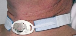 AirLife Tracheostomy Tube Holder 1