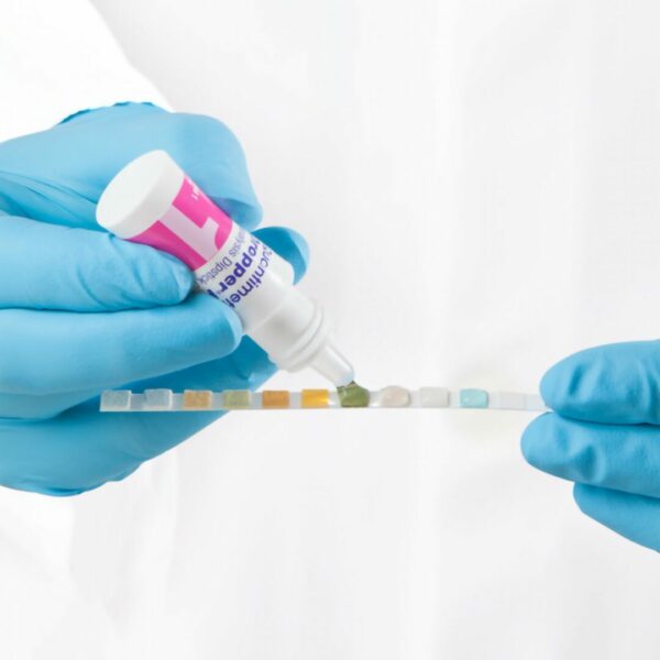 Urine Chemistry Urinalysis Control Dropper Plus Urinalysis Dipstick Testing 2 Levels 2 X 5 mL